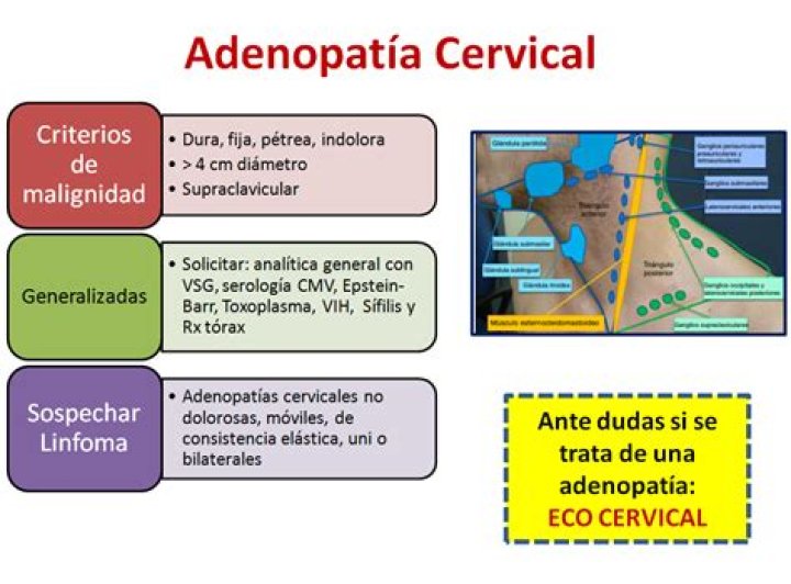 ¿Cuando una adenopatía es maligna