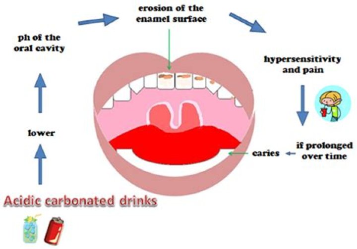 Do carbonated drinks damage bones