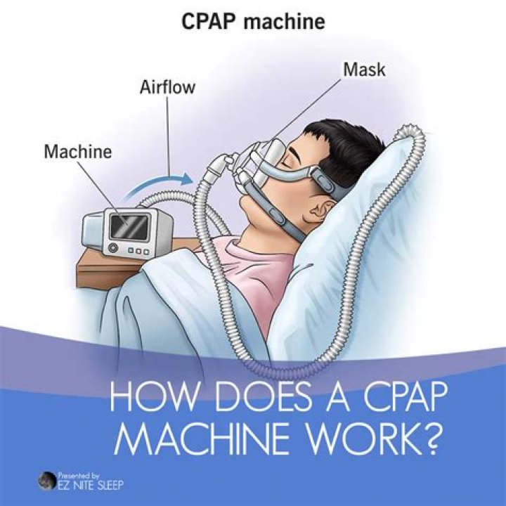 How does the CPAP improve oxygenation and ventilation