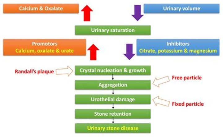 How is urolithiasis diagnosed