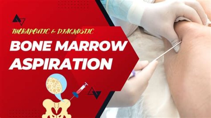 Is bone marrow aspiration painful