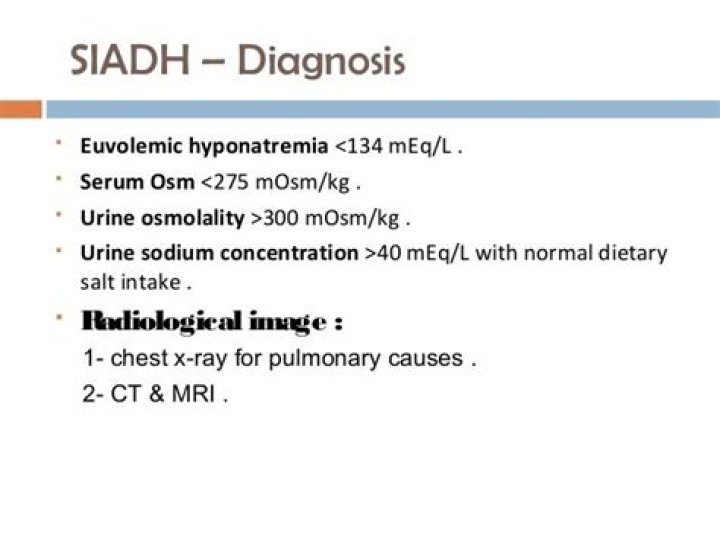 Is urine sodium high in SIADH