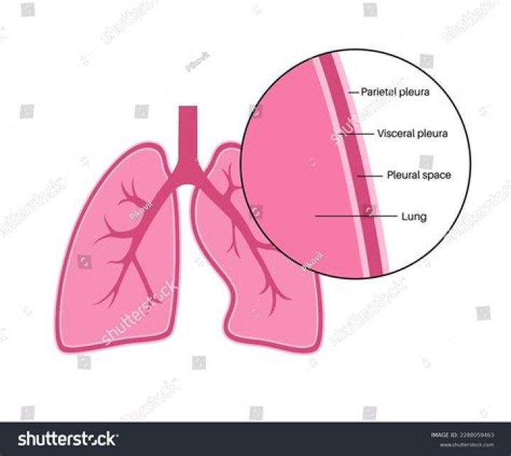 What type of tissue is the pleura